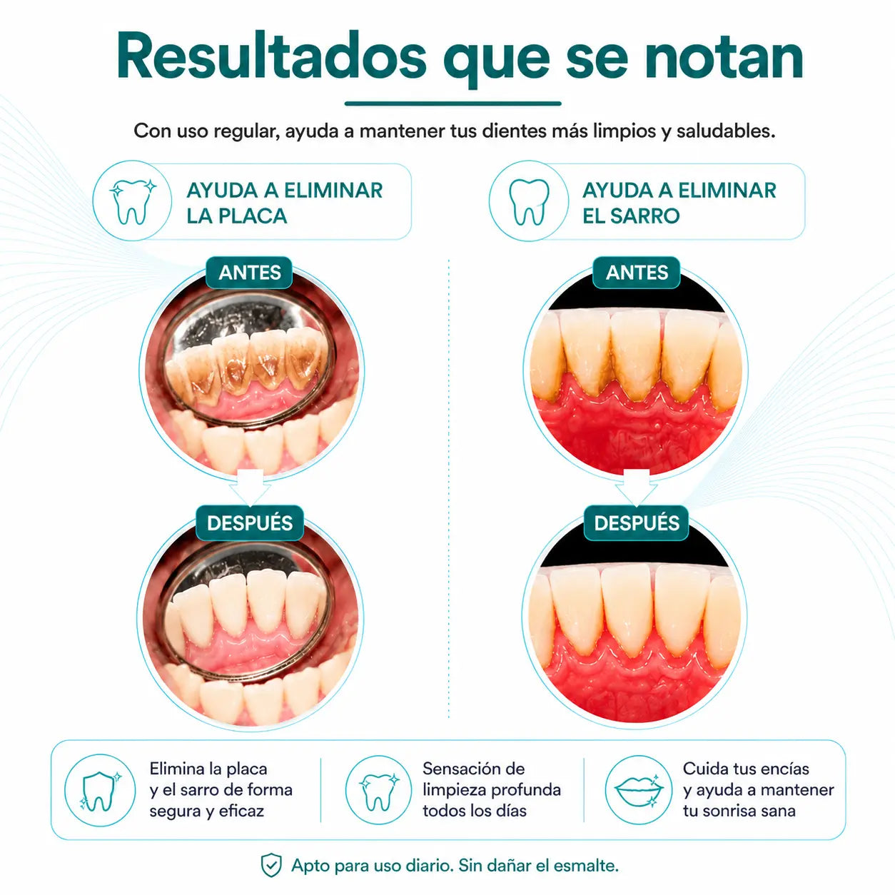CleanSmile™ Removedor de Sarro